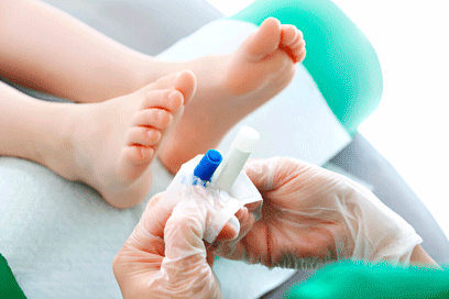 podologo barcelona realizando tratamiento hongos en los pies en clinica de podologia barcelona